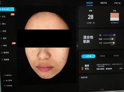 皮膚檢測儀哪家強?Visia、美圖宜膚、A-one實測