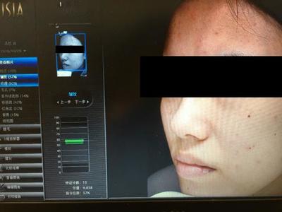 皮膚檢測儀哪家強？Visia、美圖宜膚、A-one實測深度對比