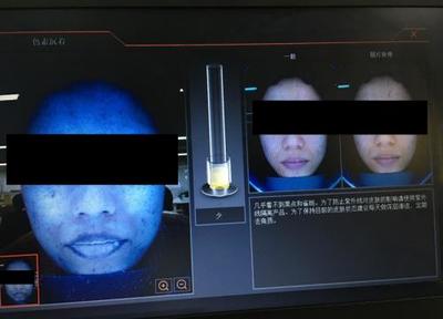 皮膚檢測儀深度實測 Visia、美圖宜膚、A-one究竟哪家強？